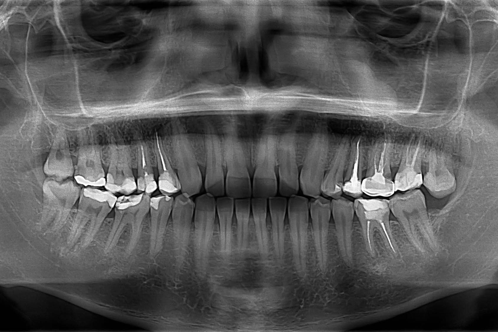 Панорамный снимок зубов Томск Корейский вероника стоматология